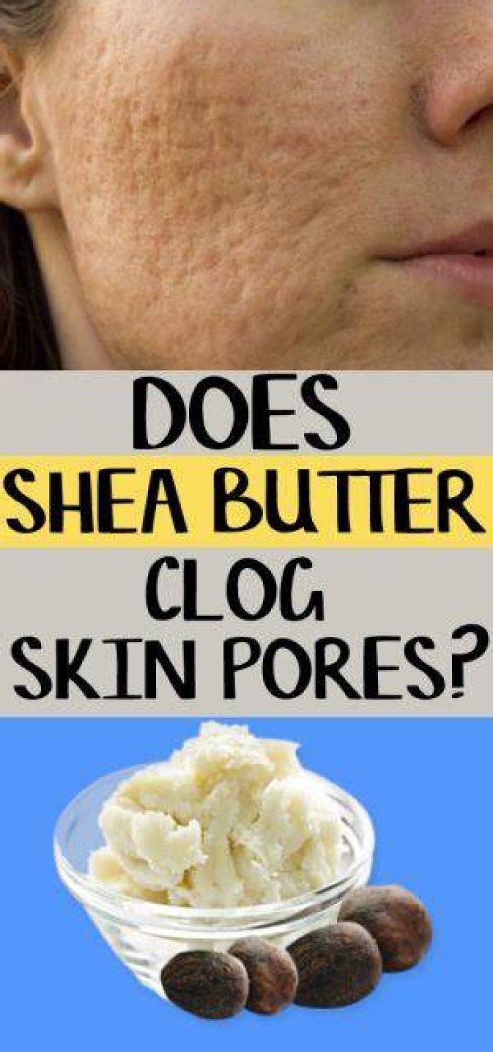 Can shea butter clog your pores?